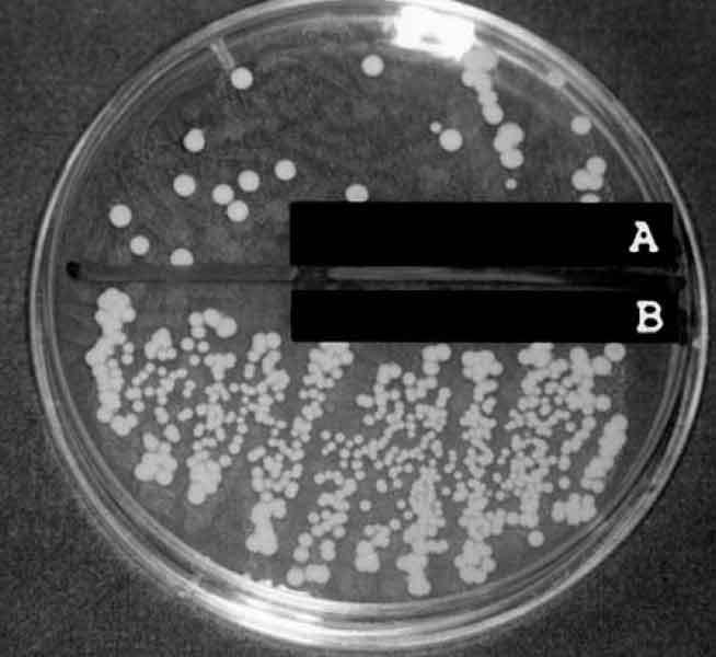 Fungal cells growing on a nutrient plate 1